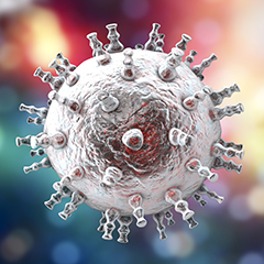 Sarcoma di Kaposi Sarcoma di Kaposi